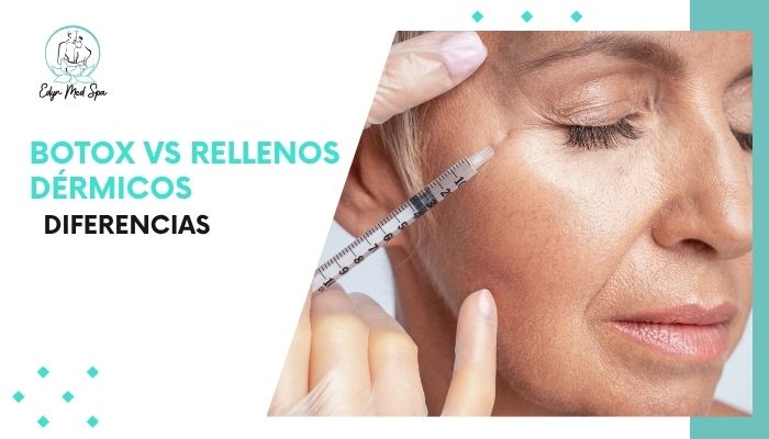 Botox vs rellenos dérmicos